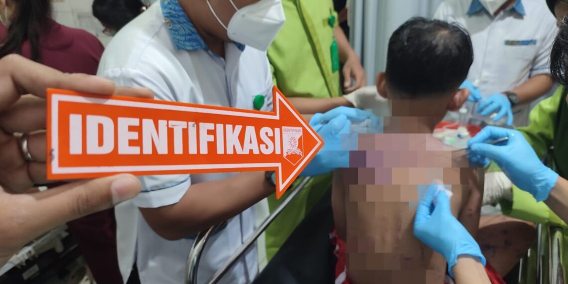 Ibu dan Anak di Sukabumi Disiram Air Keras, Polisi Buru Pelaku
