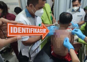 Ibu dan Anak di Sukabumi Disiram Air Keras, Polisi Buru Pelaku